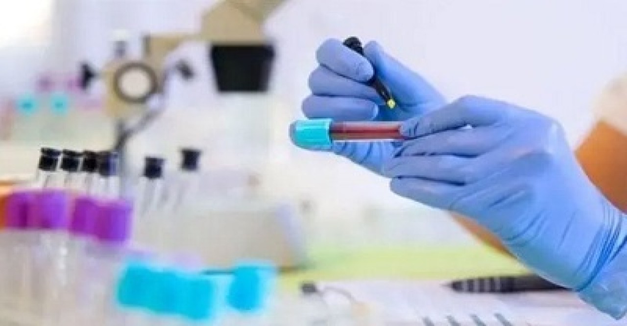 বিশ্বের সবচেয়ে বিরল রক্তের গ্রুপ কোনটি?
