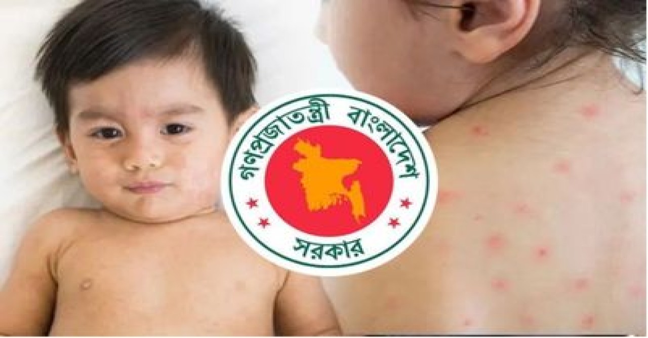দেশে হামের উপসর্গে আরও ৬ জনের মৃত্যু
